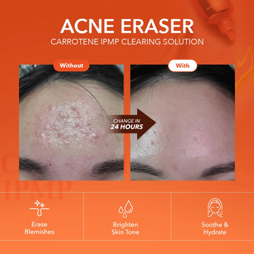 APRILSKIN - Carrotene IPMP Spot Treatment